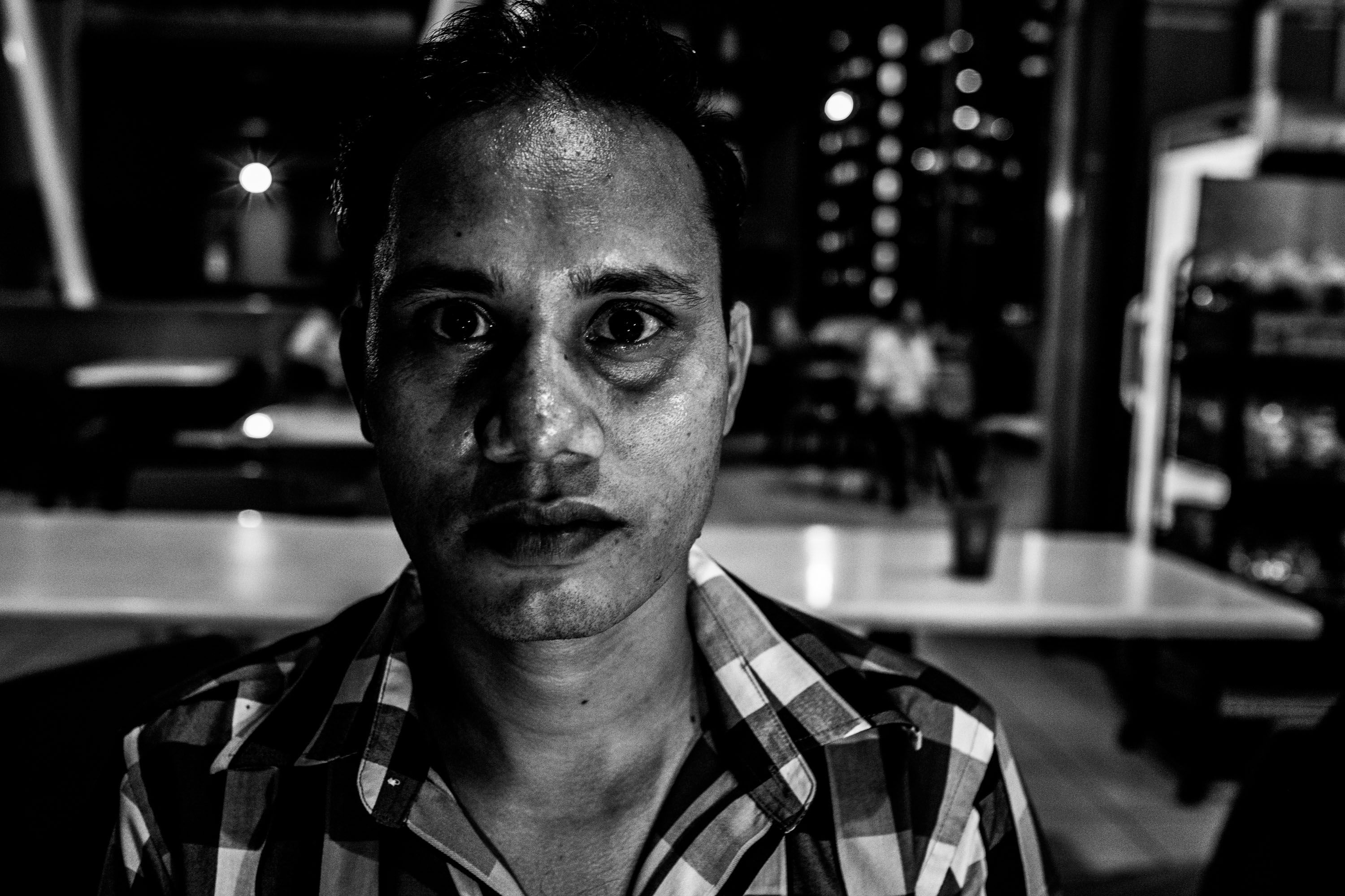 Sohag Faslul Haque, a construction worker from Bangladesh, injured his back while working. After he had a check up with a doctor, his employer sent him back without compensation. He has filed for work injury compensation, but has been out of work for months. Image by Xyza Bacani. Singapore, 2016.