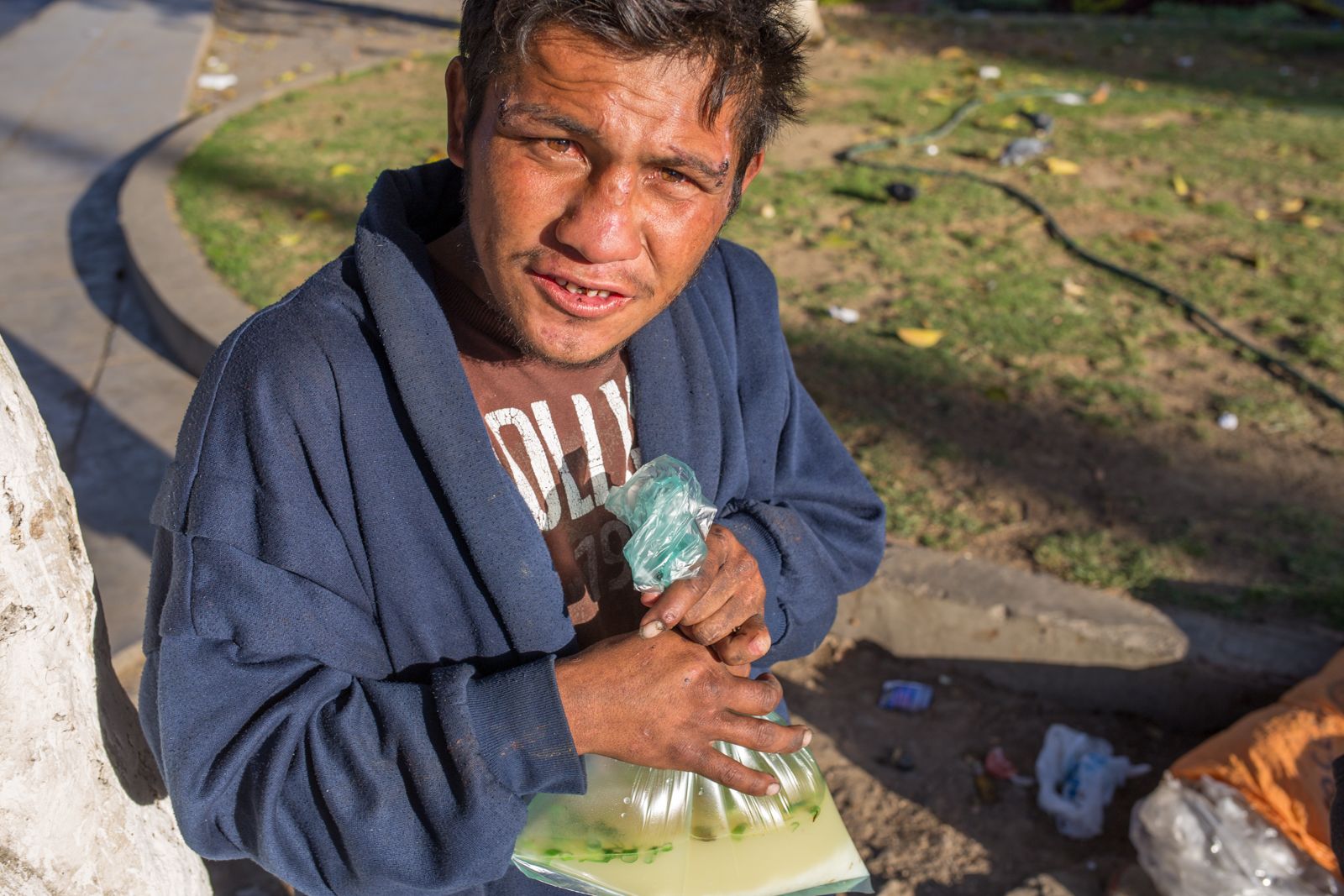 Jose Luis said he has been on the streets since age 13 and is now 22. He said he regularly inhales glue, or clefa. He said it makes him feel “bad,” but “I can’t change.” Image by Tracey Eaton. Bolivia, 2017.