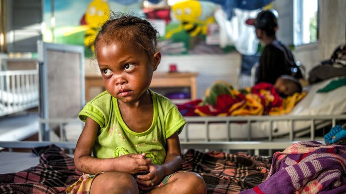 After being treated for severe malnutrition at Ifanadiana District Hospital, this girl is about to go home. Image by Rijasolo. Madagascar, 2019.