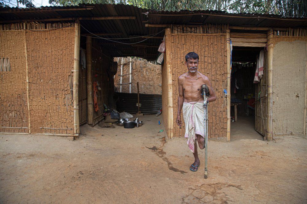 In this March 31, 2020, photo, Paresh Talukdar who lost his leg and a hand stands outside his hut in a village Jayantipur in eastern Indian state of Assam. Talukdar supports a family of five on the $2.50 or so he makes in a day by begging. India has launched one of the most draconian social experiments in human history, locking down its entire population, including hundreds of millions of people who struggle to survive on a few dollars a day. Image by AP Photo/Rajesh Kumar Singh. India, 2020.