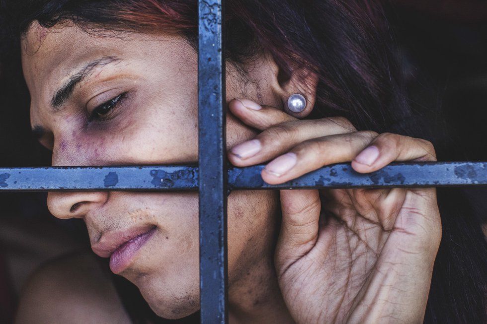Una mujer transgénero muestra sus heridas en el centro de detención de Valencia, Carabobo (Venezuela), en 2017. Imagen por Ana Maria Arevalo.