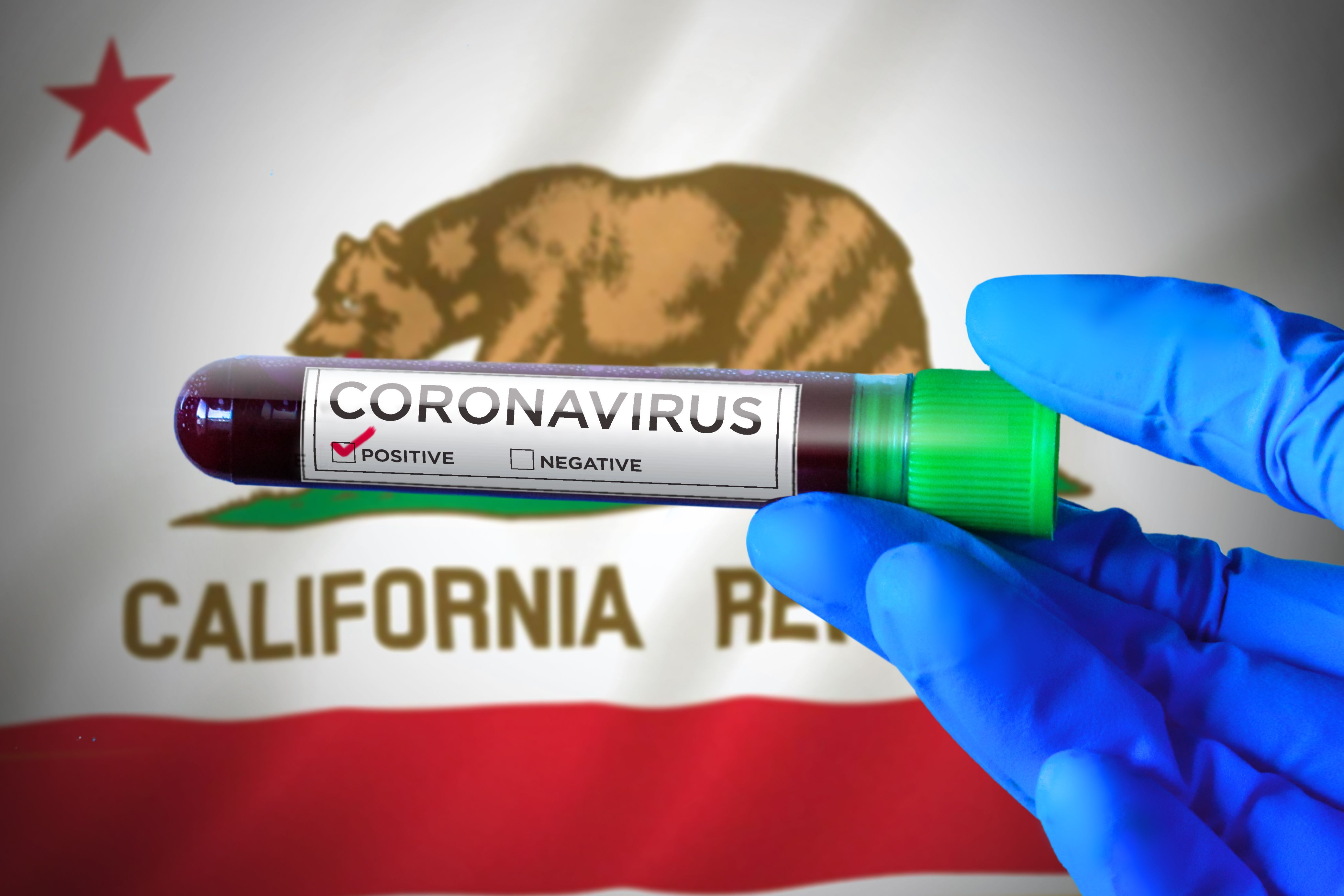 California has closed 11 public health labs over the past two decades, impeding the implementation of "targeted testing." Image by Kim Kuperkova / Creative Commons. United States, 2020. 