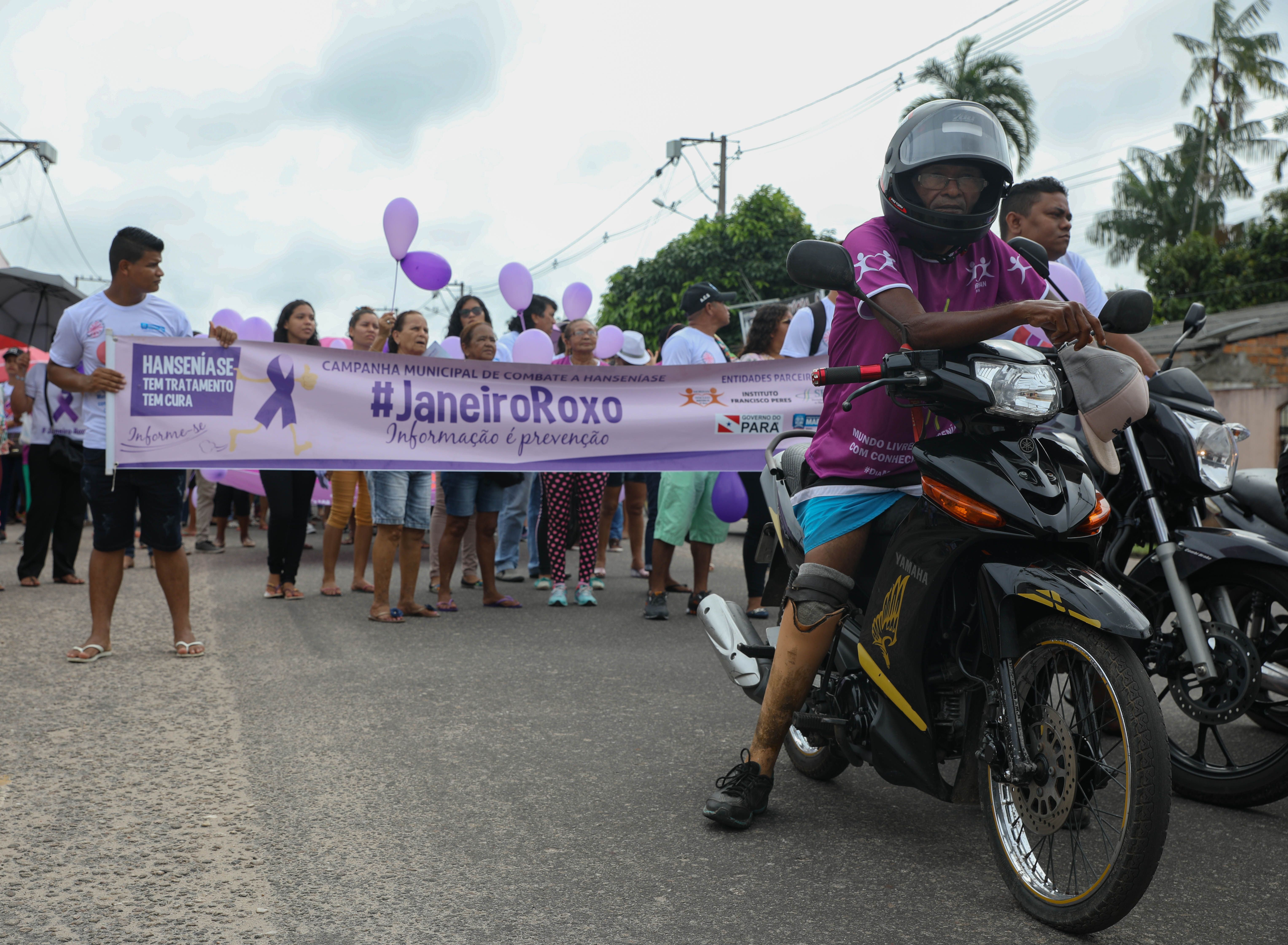 A former leprosy patient, who lost his leg to the disease, leads a leprosy awareness march on his motorcycle in Marituba. Image by Anton L. Delgado. Brazil, 2020.