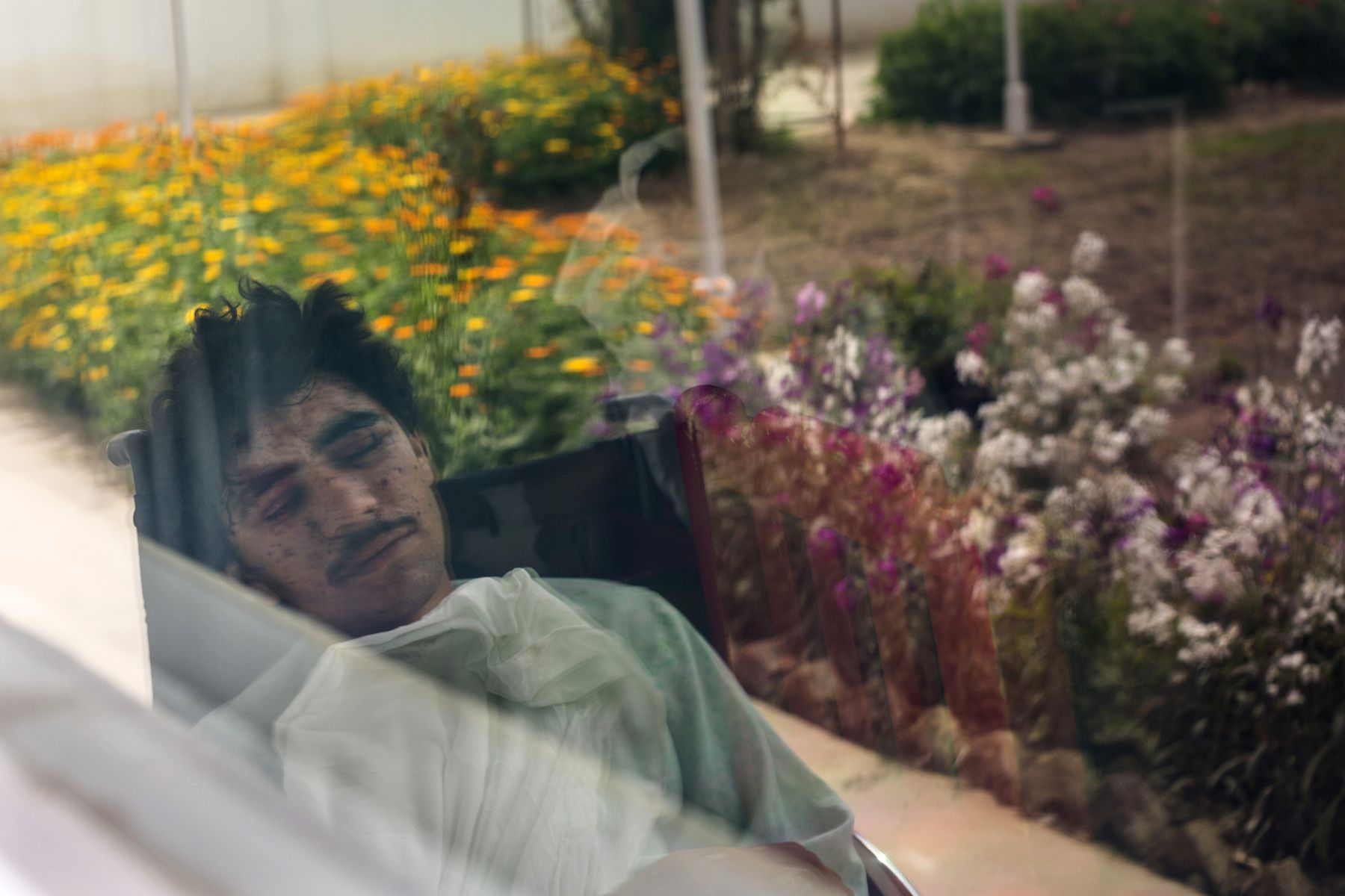 Kharim Ahmad, 22, suffered shrapnel wounds on his face and the loss of a leg from fighting in Sangin. He was being treated at the Emergency hospital in Lashkar Gah, Afghanistan. Image by Paula Bronstein. Afghanistan, 2015.