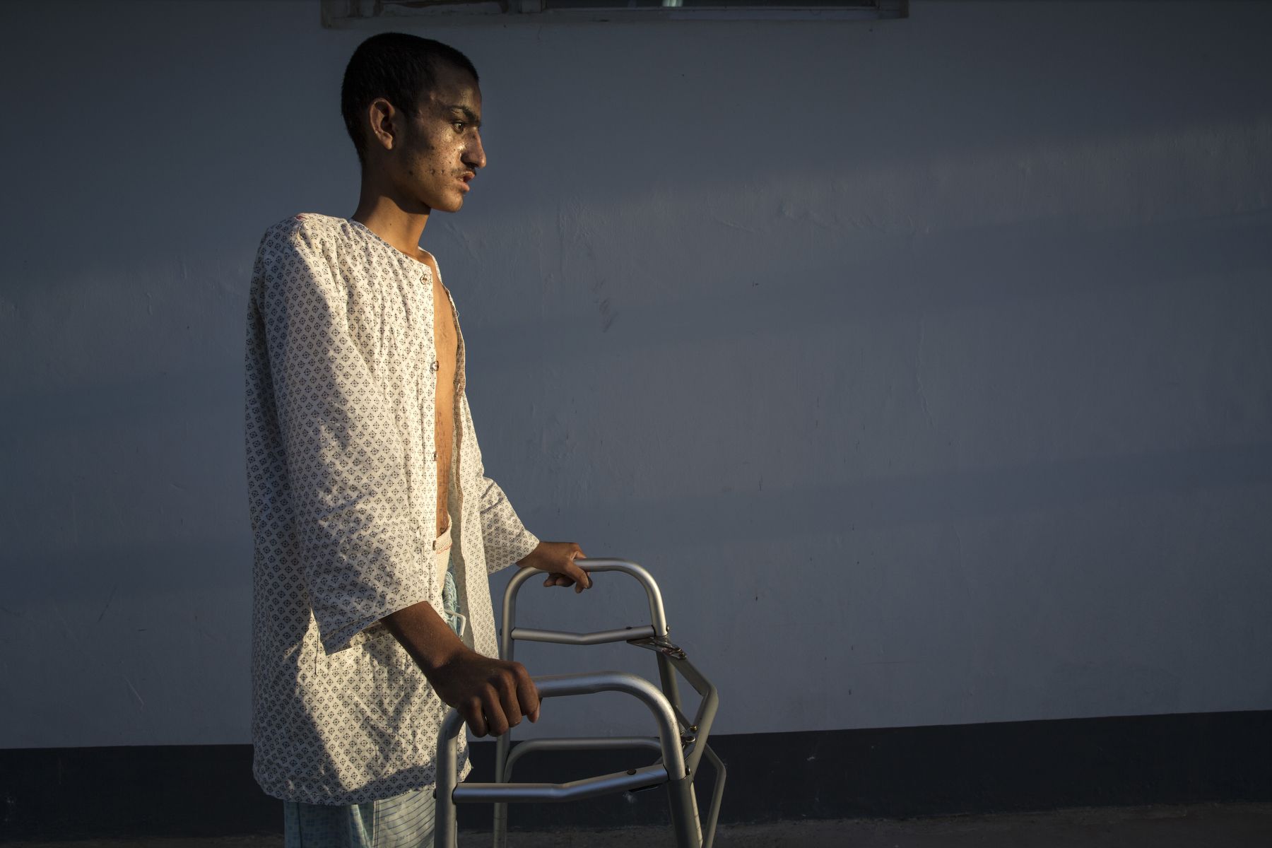 Ahah Kahn, 19, is barely able to walk after a serious brain injury caused by an IED. Atah was a sheep herder from Helmand who had been at the hospital for a month recovering his strength. Lashkar Gah, Afghanistan. Image by Paula Bronstein. Afghanistan, 2015.