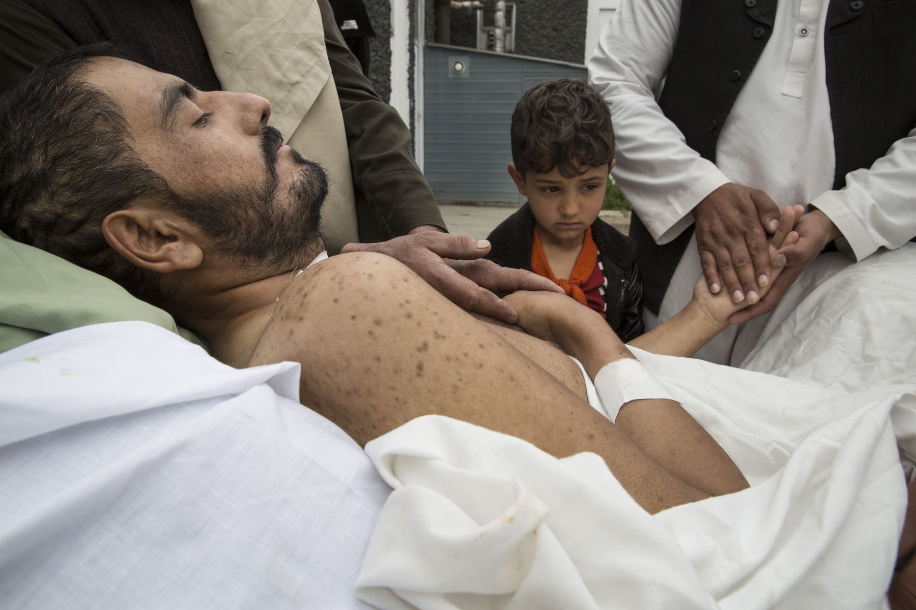 Khair Mohammed, 35, a paraplegic, lays in bed outside his ward as friends and relatives—including his daughter, Madina, 6—visit him at the emergency hospital in Kabul on March 28, 2016. Mohammed had barely escaped death after taking 3 bullets to his abdomen and skull. Image by Paula Bronstein. Afghanistan, 2016.