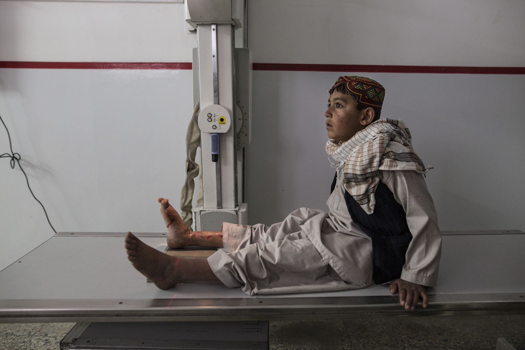 At the Emergency hospital a Pashtun boy waits for an X-ray on his leg from a mine injury in Kabul on March 29, 2016. Image by Paula Bronstein. Afghanistan, 2016.