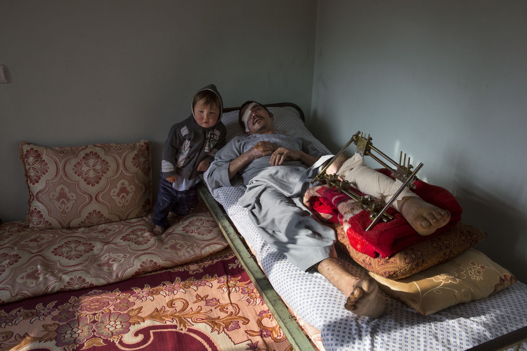 Abdul Hussain Ayoobi, is seen at home with his son Ali Akbar, 3. Abdul, a carpenter was one of the seriously wounded victims for Tolo TV. The employees had finished a day’s work at Tolo TV, one of Afghanistan’s largest entertainment channels, when they boarded a company bus in Kabul on April 9, 2016. It was rammed by a car driven by a Taliban suicide bomber. Seven people were killed and at least 25 wounded in the attack. Image by Paula Bronstein. Afghanistan, 2016.
