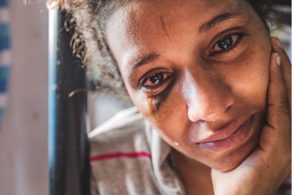 Yusbelis Bustamante, 23, cries while showing her injuries from a fight with another inmate at La Yaguara Detention Center, Caracas. She is 4 months pregnant, but in her seven weeks of detention, she had not received any medical checkups. Image by Ana María Arévalo. Venezuela, 2018.
