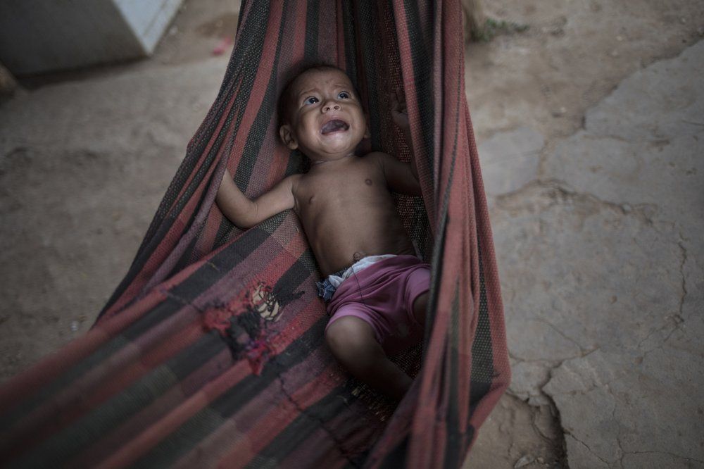 FILE - In this Nov. 25, 2019 file photo, Osmery Vargas, who is malnourished, cries in a hammock as she and her 7-year-old sister Yasmery Vargas wait for their mother to return from begging in the street for money and food in Maracaibo, Venezuela. Even before the coronavirus pandemic in 2020, inflation had rendered many salaries nearly worthless and forced millions to flee abroad. Image by Rodrigo Abd/AP Photo. Venezuela, 2019.