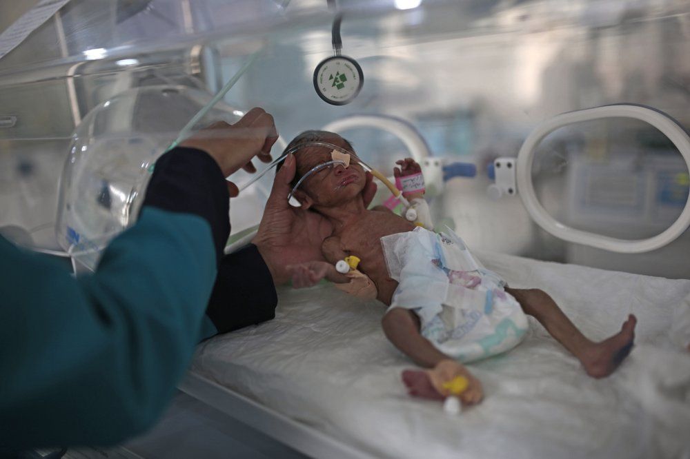 FILE - In this Saturday, June 27, 2020 file photo, a medic checks a malnourished newborn baby inside an incubator at Al-Sabeen hospital in Sanaa, Yemen. A UNICE report predicted that the number of malnourished children could reach 2.4 million by the end of 2020, a 20% increase. Image by Hani Mohammed/AP Photo. Yemen, 2020.
