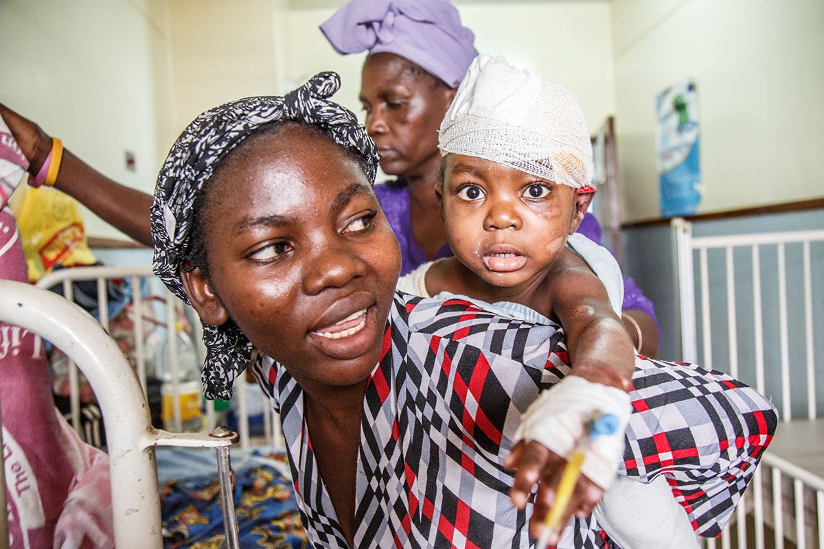 Jacqueline, 2, just comes from the operating room. She suffered severe burns and underwent second surgery at Kamuzu Central Hospital in the capital of Malawi Lilongwe. Her mother Eliza has good hope that she will be healthy again soon. Image by Nathalie Bertrams. Malawi, 2017.