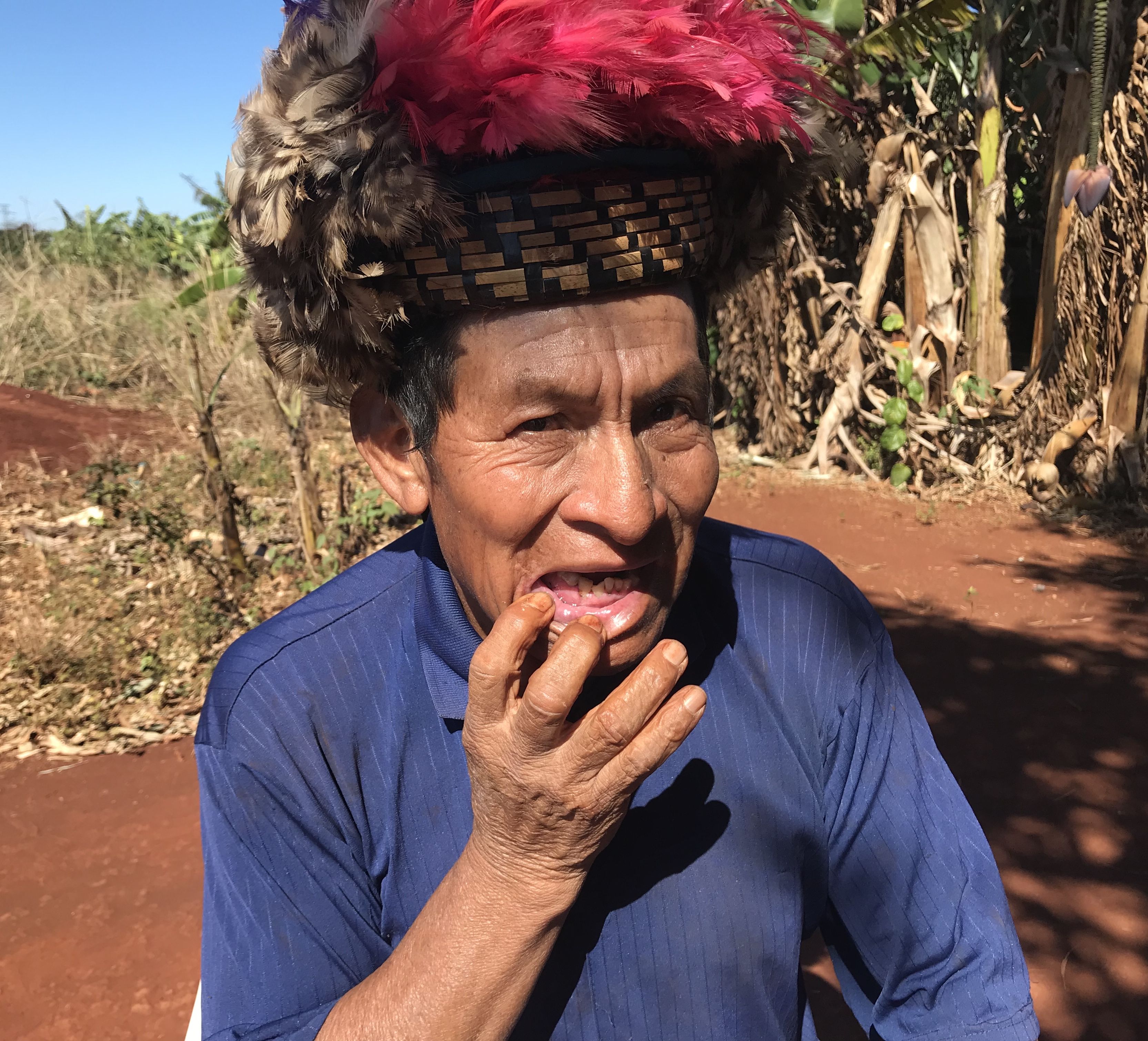 Cacique Ambrosio Ricardi (Guarani-Kaiowá) shows his broken jaw and teeth. Both are results of an assault to his settlement in the outskirts of Dourados, Mato Grosso do Sul. Image by Rafael Lima. Brazil, 2019.