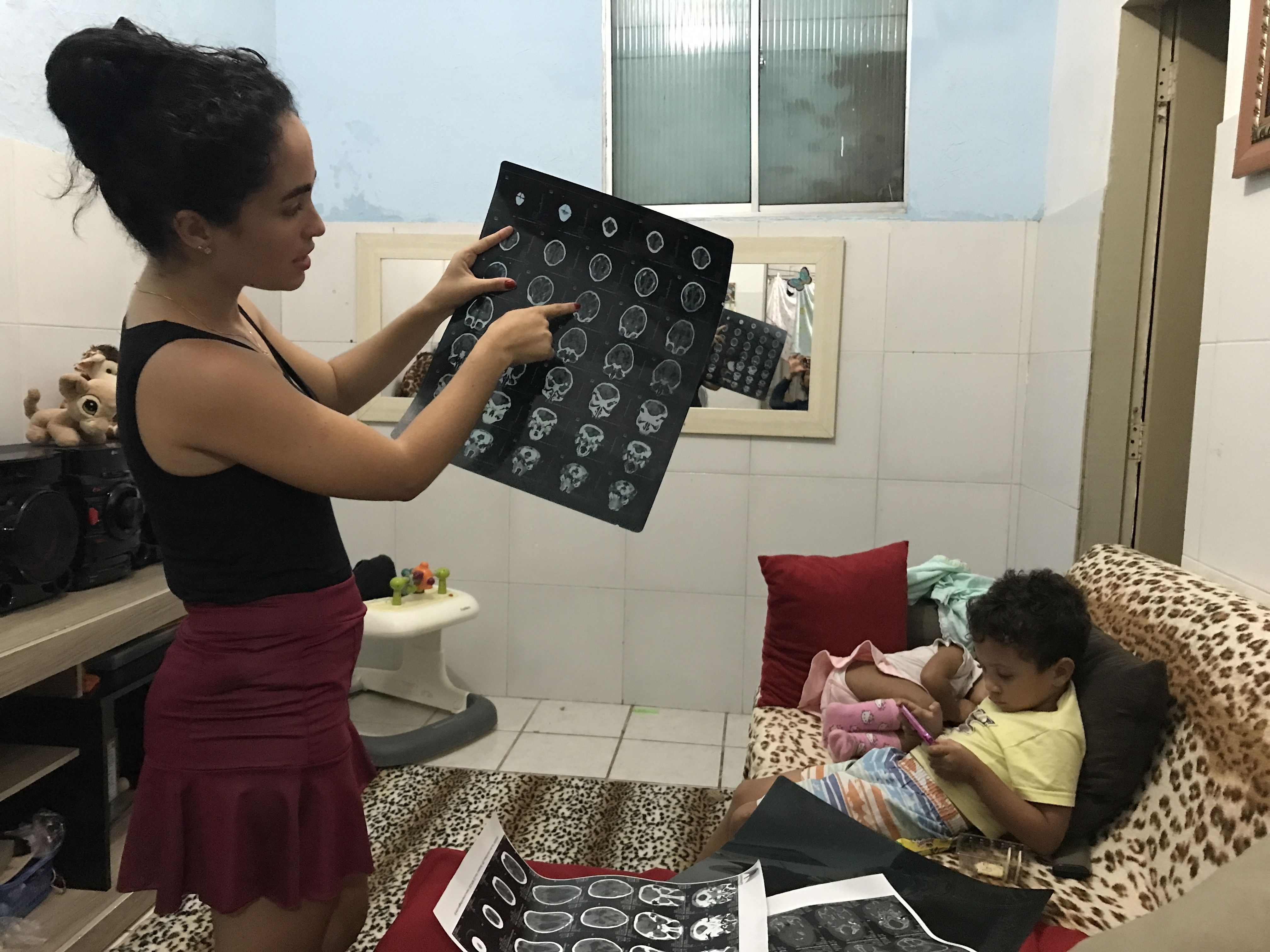 Dhulha Alen Silva do Nascimento, 25, explains a CT scan of daughter Valentina’s brain, pointing out areas of calcification and hydrocephalus. Image by Poonam Daryani. Brazil, 2017.