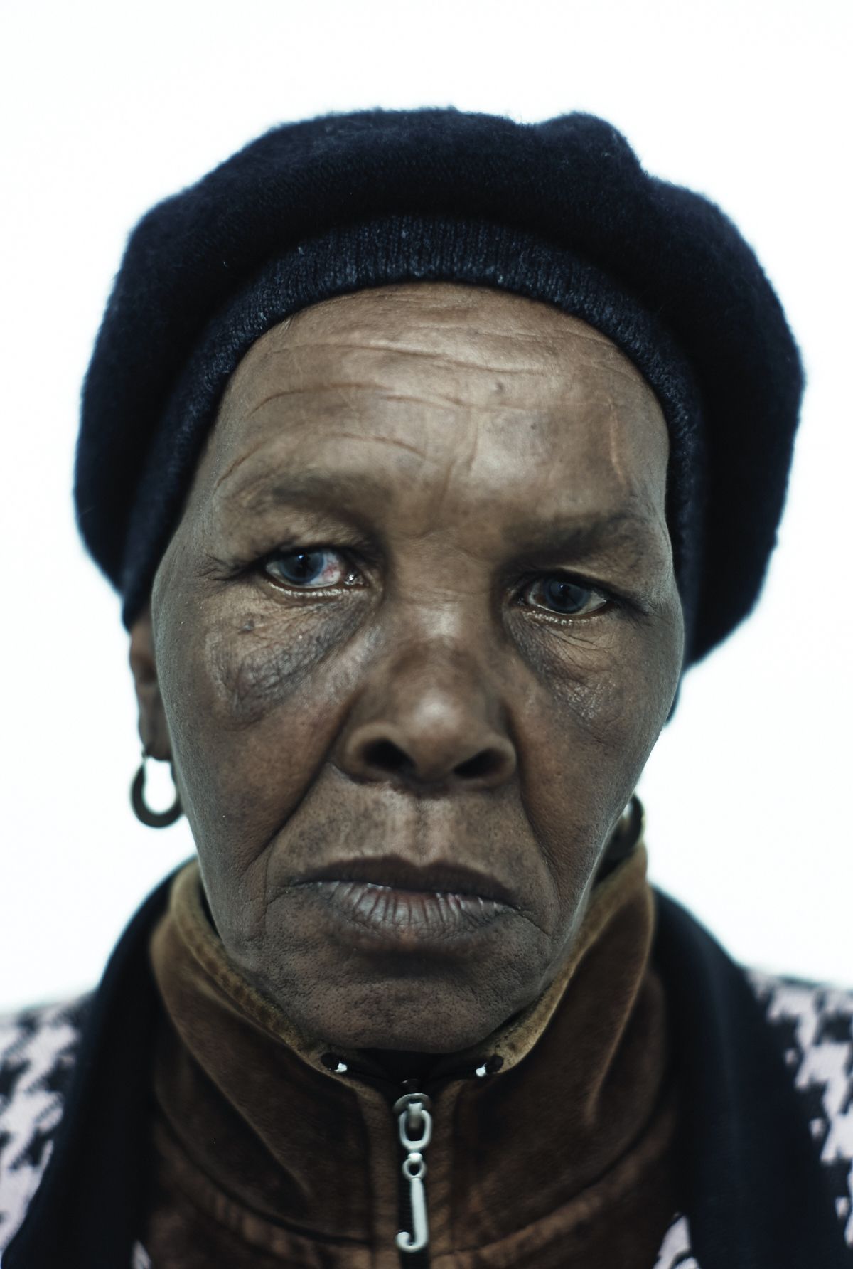 Orianda during her frequent visits to the clinic for tuberculosis treatment. Image by Misha Friedman. South Africa, 2013.