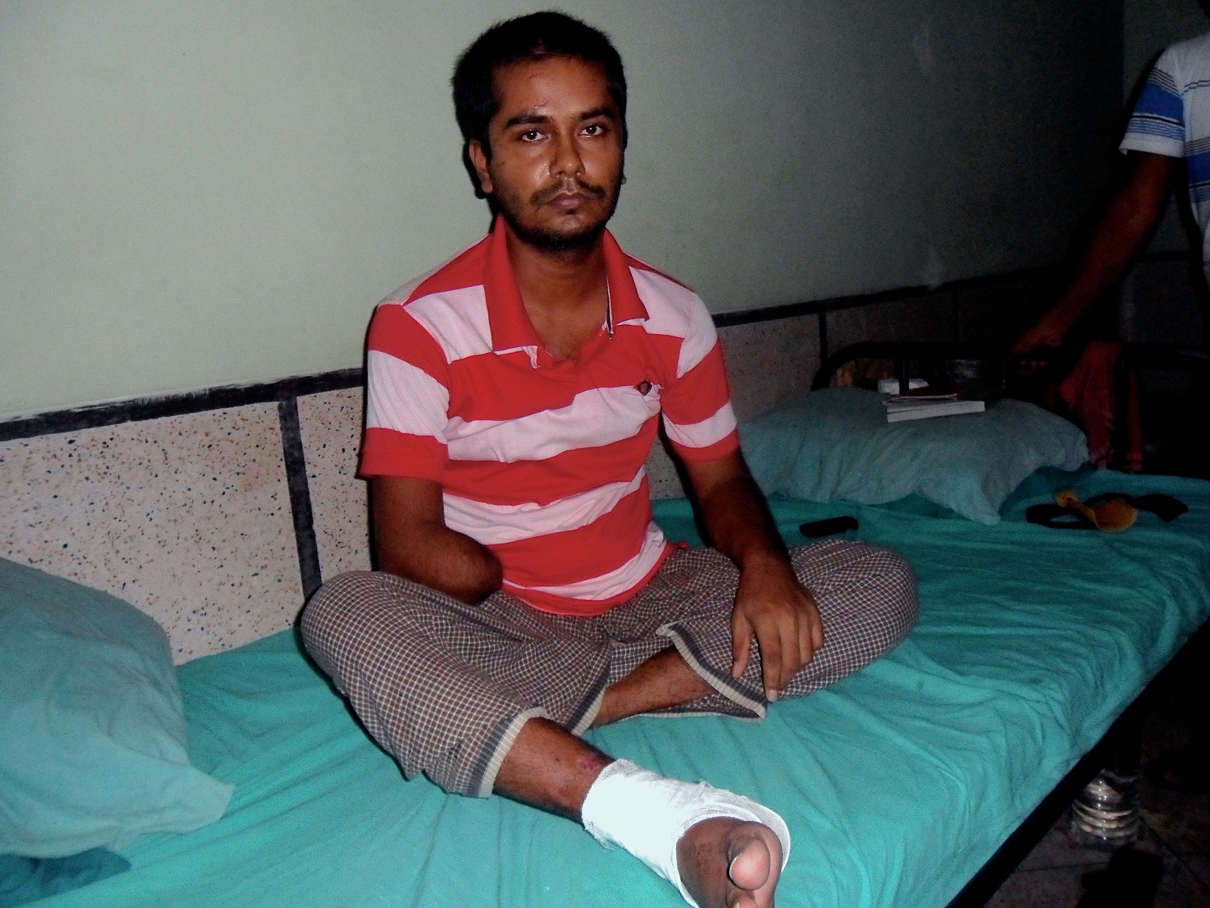 Rana Plaza survivor Saddam Hossain recovers in a hospital after the building collapse claimed part of his right arm. Image by Golam Mortuja. Bangladesh, 2016. 