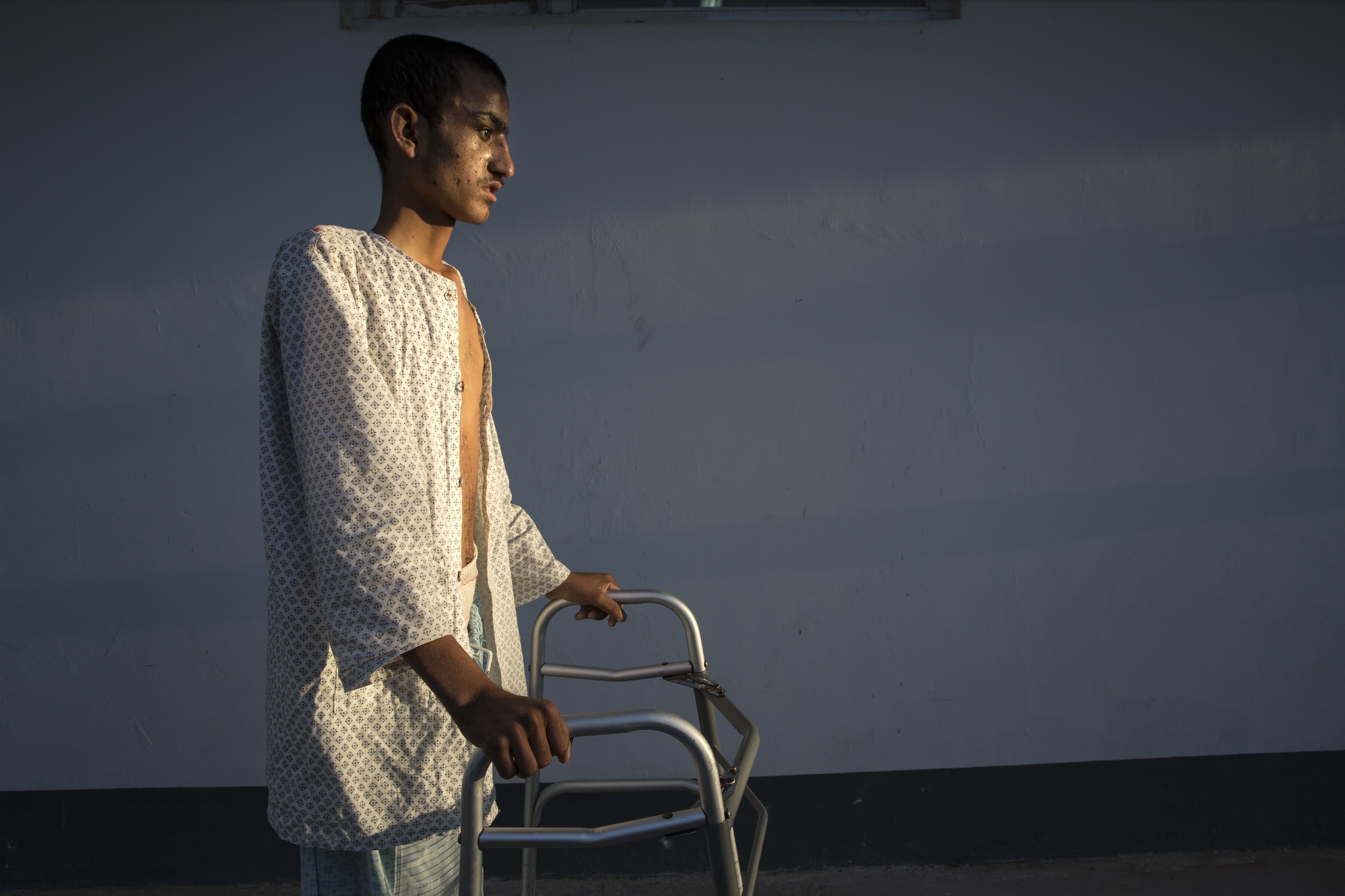 Ahah Kahn is a shepherd from Helmand, but today he is barely able to walk due to a brain injury from an incendiary explosive device. Image by Paula Bronstein. Afghanistan, 2015. 