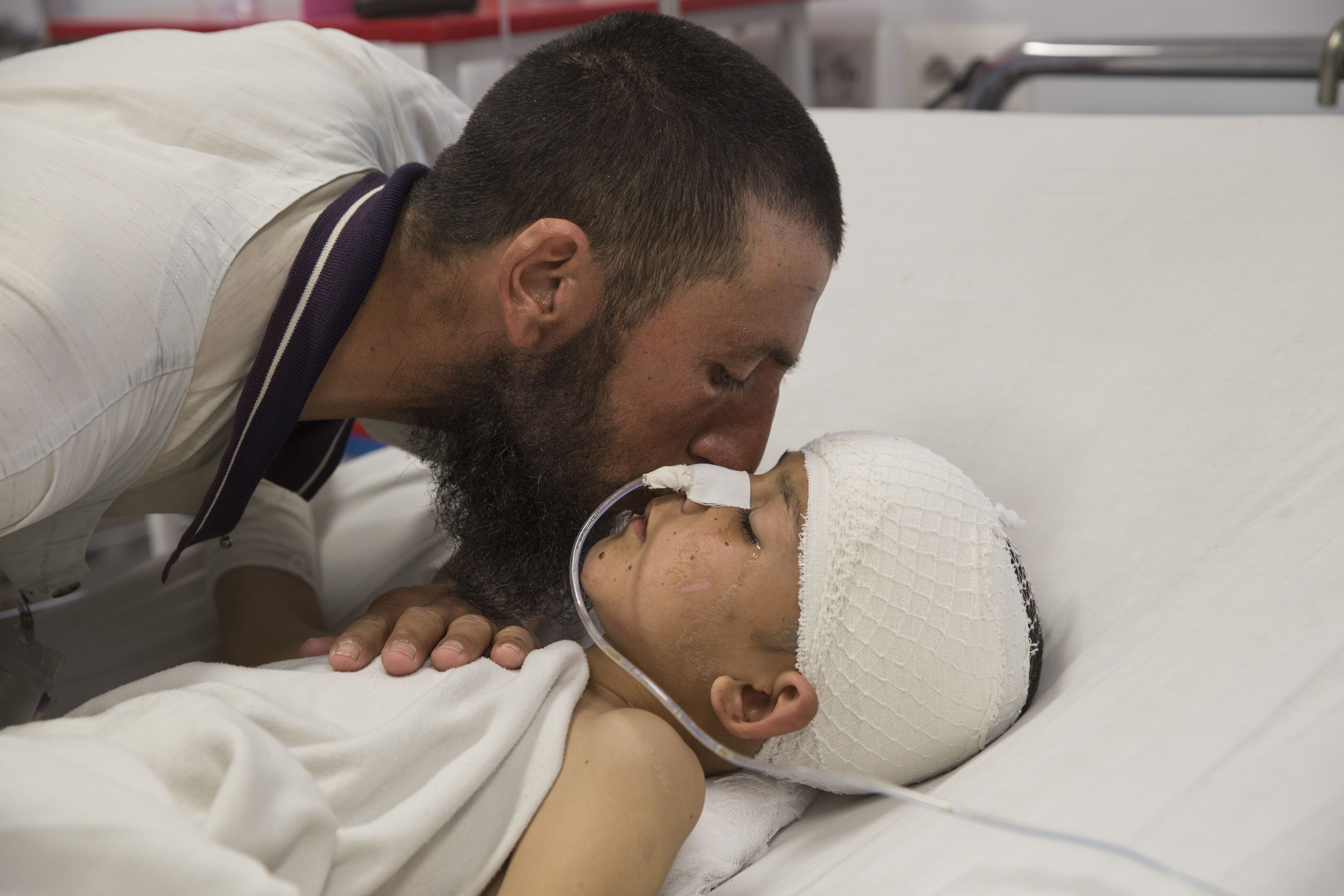 Abdul Kabir kisses his son Noor Ahmad, unconscious with a severe brain injury from an improvised explosive device. Noor was also injured from the explosion, but fully recovered. Image by Paula Bronstein. Afghanistan, 2015. 