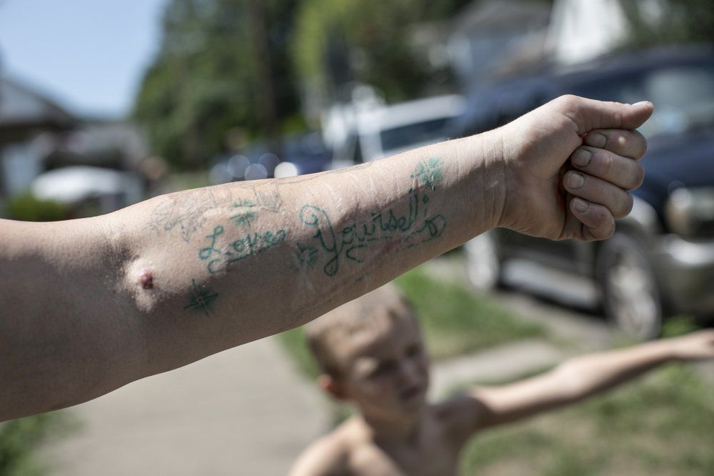 Brittany Cunningham 31, shows off her tattoo which reads, "Love Yourself" on her left forearm in Nelsonville, Ohio, on Friday, July 24, 2020. "Those are to hide the suicide scars," she said. Image by Wong Maye-E/AP Photo. United States, 2020.
