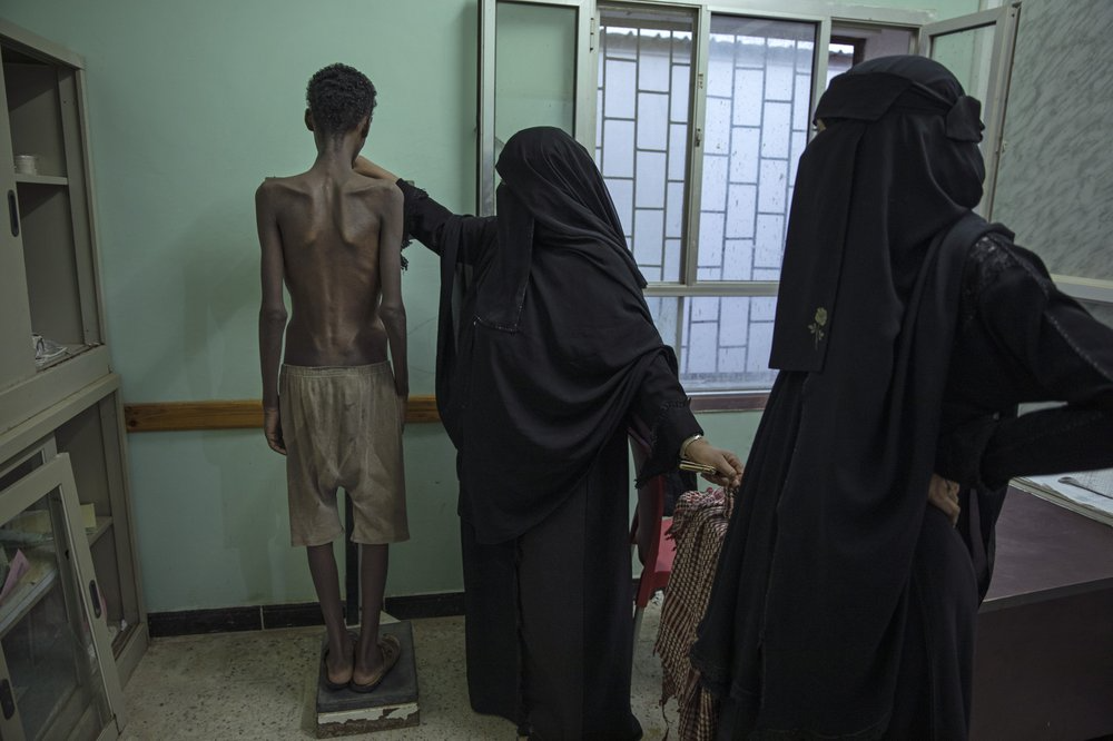 19-year-old Ethiopian migrant Mohammed Hussein, who is severely malnourished from imprisonment by smugglers, stands on a scale at the Ras al-Ara Hospital in Lahj, Yemen. He weighs 31 kilograms (68 pounds). Starvation is a punishment used by the traffickers to wear down their victims. Image by Nariman El-Mofty. Yemen, 2019.