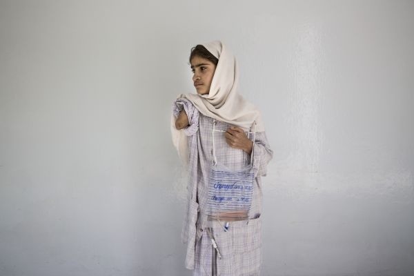 Madina, 12, lost her arm, when a rocket hit her home in Paktia, Kabul on April 6, 2016. She is recovering from an operation from complications with her pancreas at the Emergency hospital. Image by Paula Bronstein. Afghanistan, 2016.