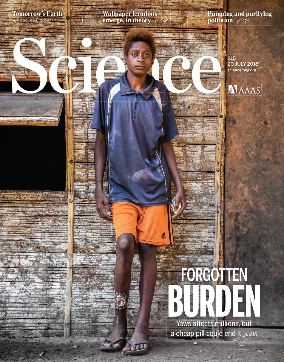 The Science Magazine cover for the award-winning story featured Stanis Malom, a 15-year old Papua boy whose leg is disfigured by yaws disease. Image by Brian Cassey. Papua New Guinea, 2018. 