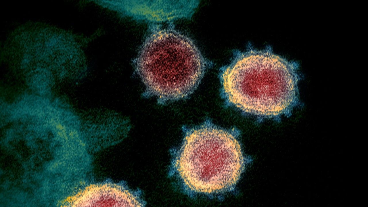 The pandemic coronavirus SARS-CoV-2 (shown above) may under certain conditions integrate its genetic material into human cells, confounding COVID-19 diagnostic tests. Image by NIAID.