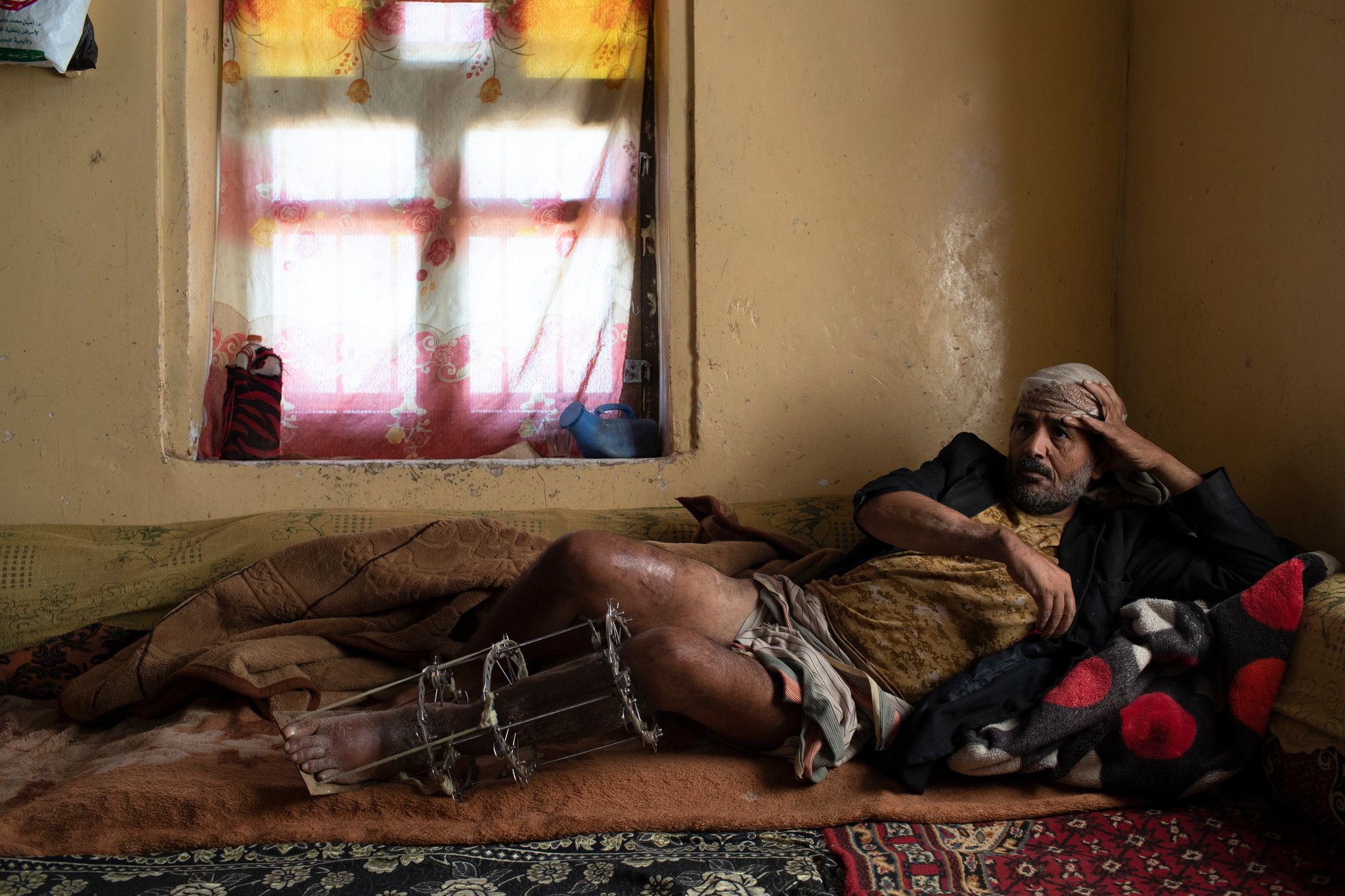 Abdullah Malfi Qasim, who was injured in an airstrike in Arhab. Image by Tyler Hicks/The New York Times. Yemen, 2018.