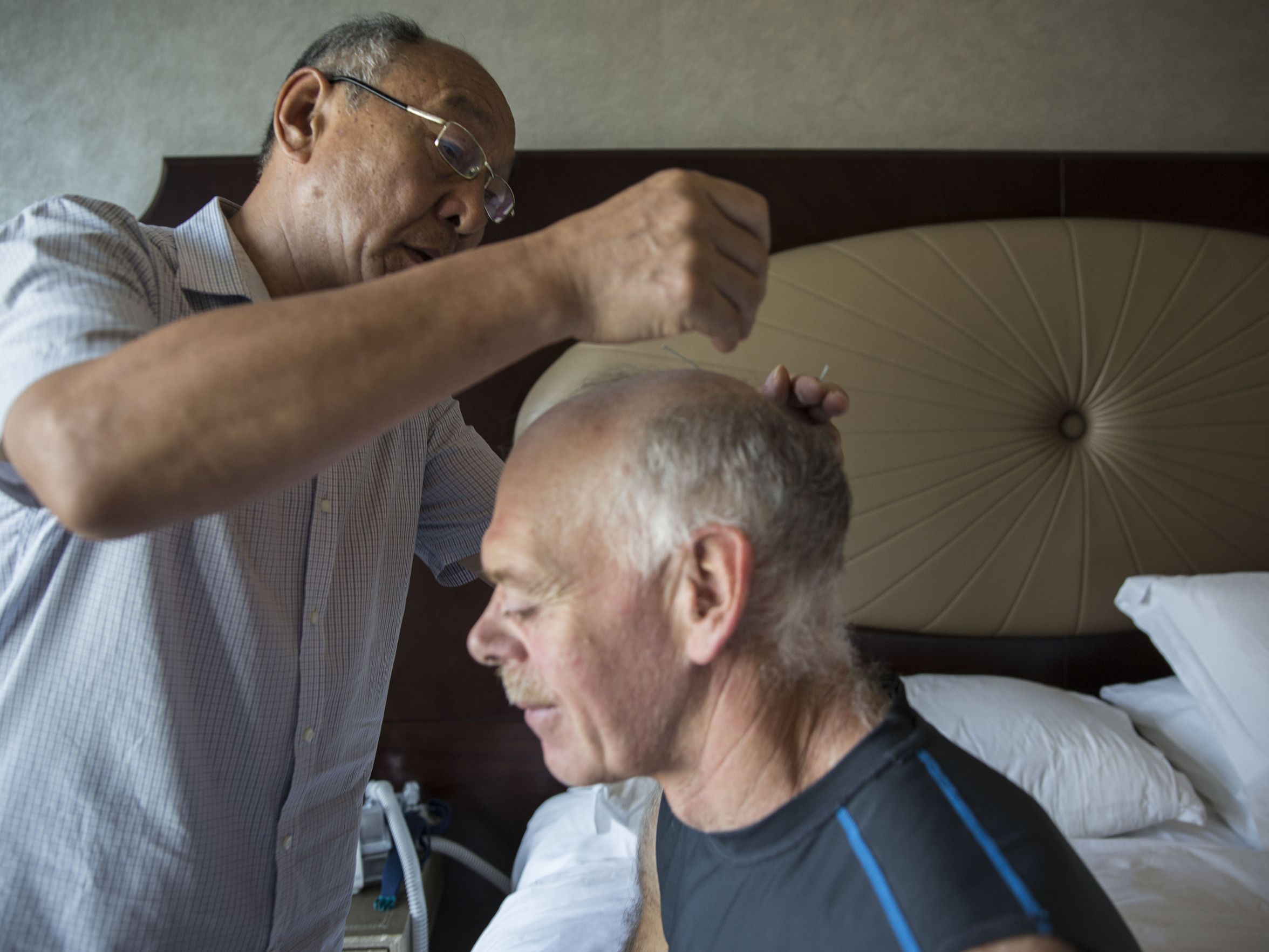 Jim Detweiler, of Williamsburg, Iowa, receives an acupuncture treatment from Dr. Zhang Shulin on Wednesday, Sept. 20, 2017, at the St. Regis hotel in Tianjin, China. Detweiler came to China to use traditional medicine as a treatment for his chronic inflammatory demyelinating polyneuropathy. Image by Kelsey Kremer. China, 2017.