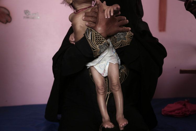 Mothers hold their children suffering from malnutrition in Yemen. Image by Nariman El-Mofty. Yemen, 2018.