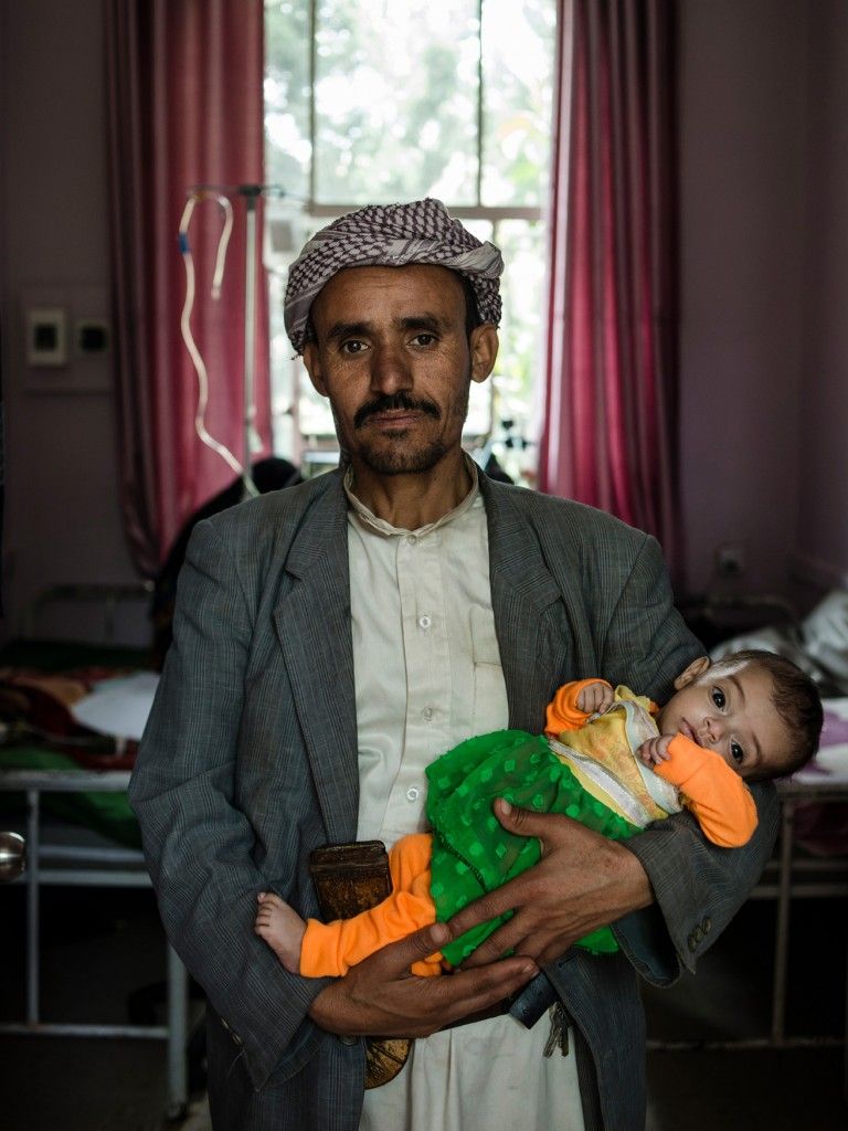 Ali Qasim al-Ajil holds his malnourished 6-month-old daughter, Kawthar. Image by Alex Potter. Yemen, 2018. 