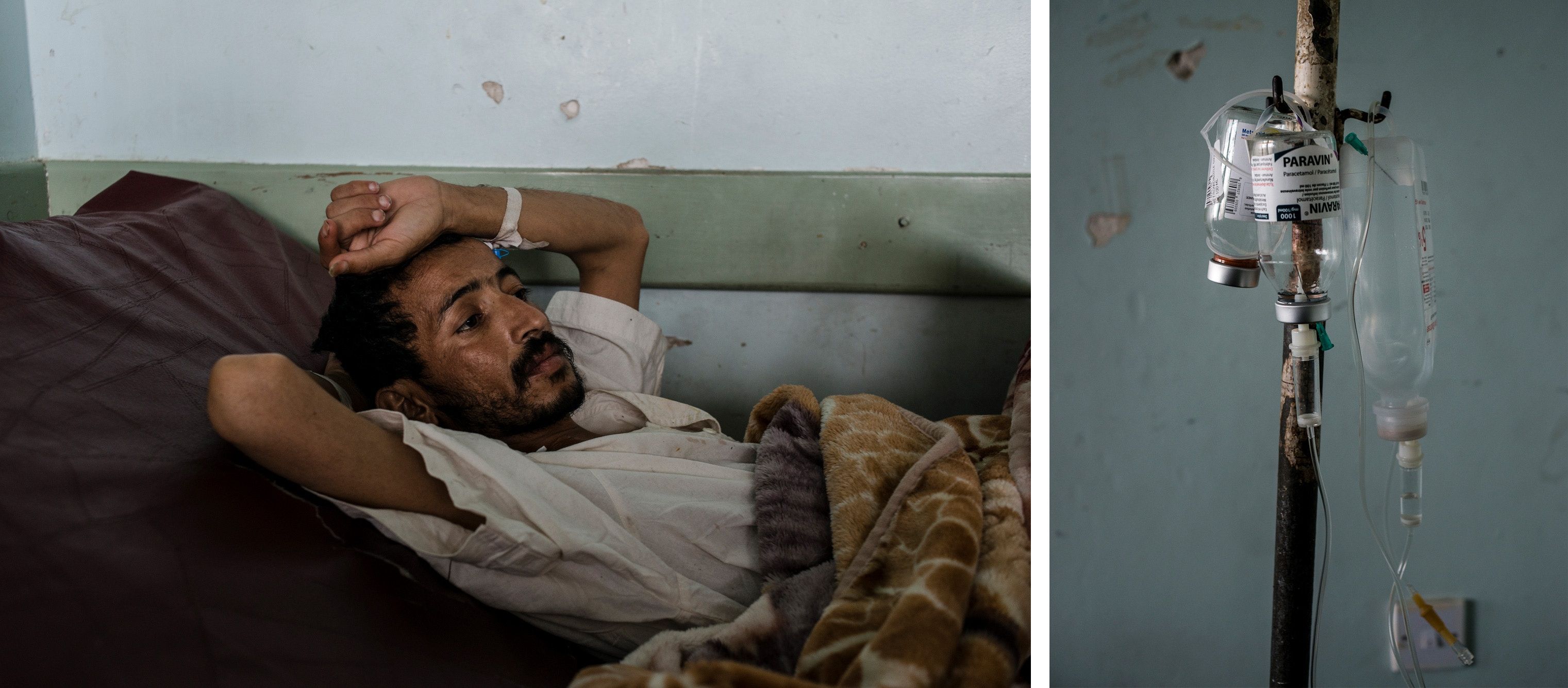 Ahmad Mohammad Morshid, who recently underwent his first round of dialysis for kidney failure, recovers in his bed on May 4, 2018, at Jumhuri Hospital. Image by Alex Potter. Yemen, 2018. 