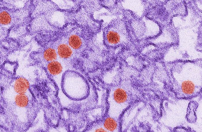 Transmission electron micrograph (TEM) of the Zika virus. Image by Centers for Disease Control and Prevention.
